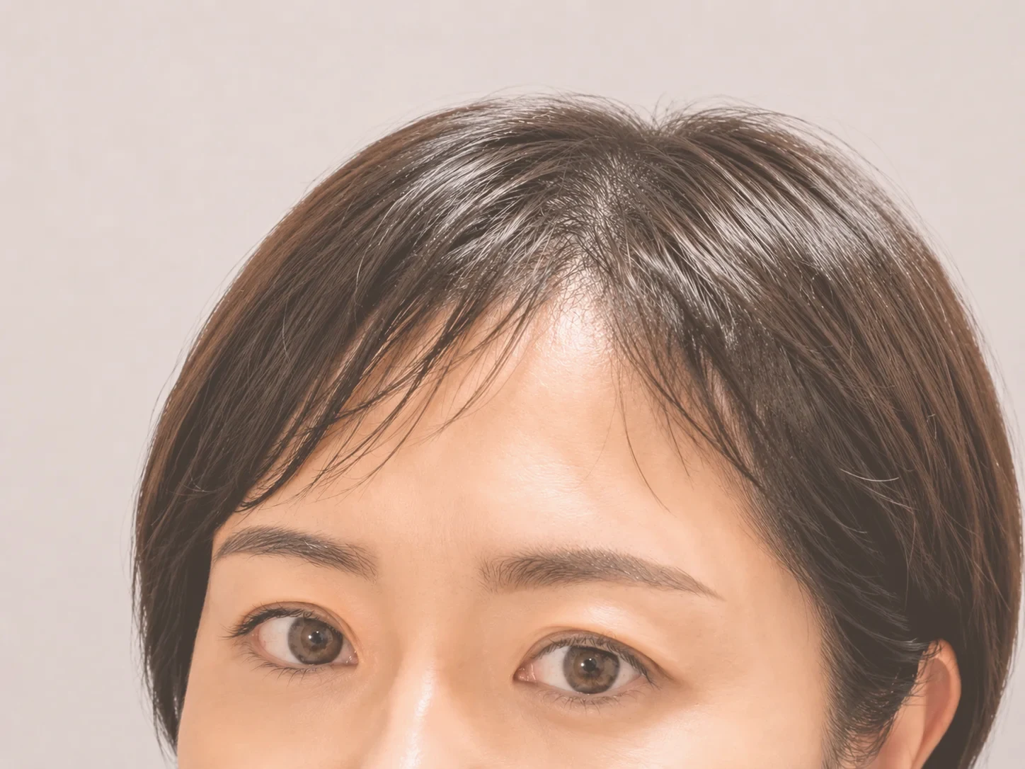 眉施術後（事例2）